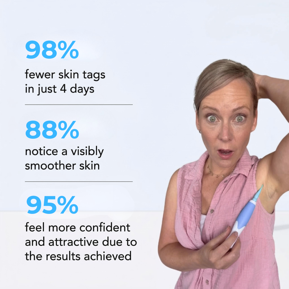 HeyTaggy™ – No More Skin Tags