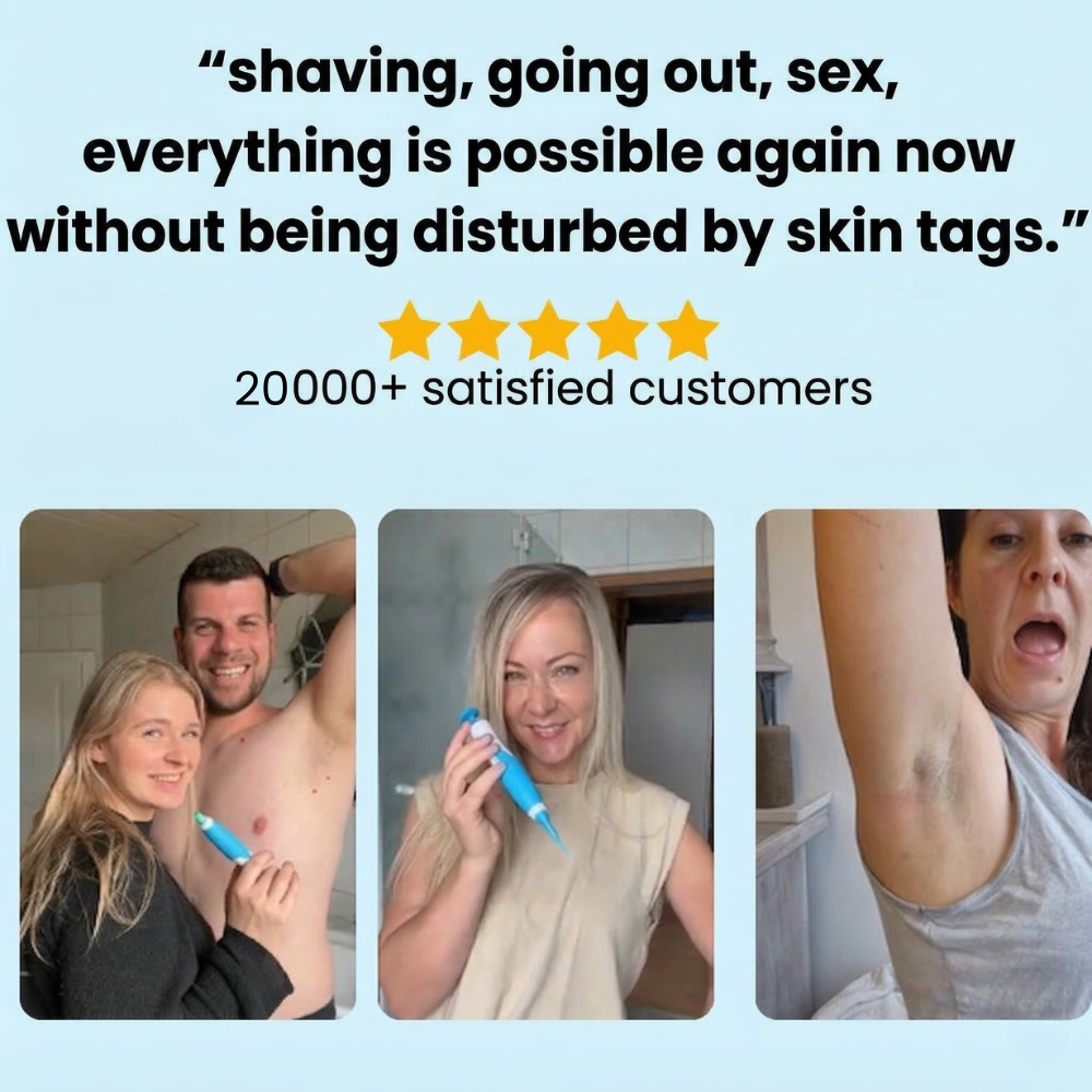 HeyTaggy™ – No More Skin Tags